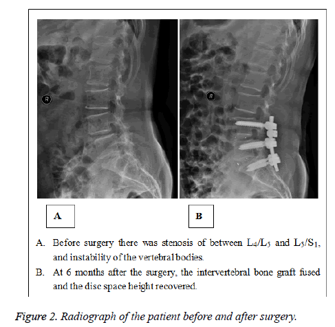 biomedres-Radiograph-patient