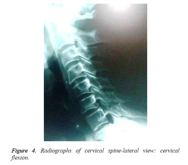 biomedres-Radiographs-cervical