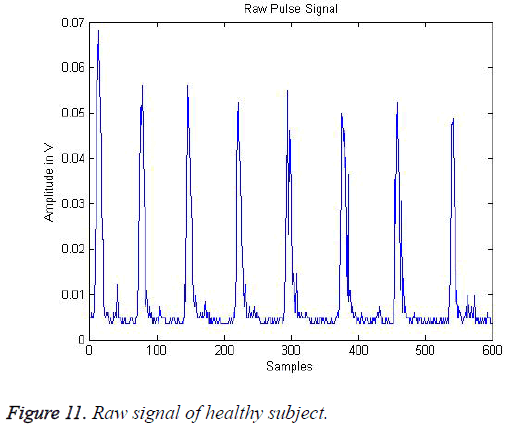 biomedres-Raw-signal-healthy