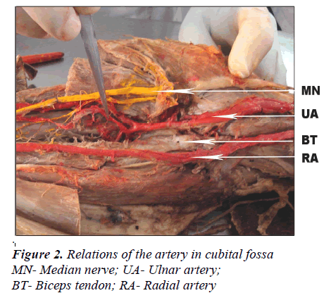 biomedres-Relations-artery-cubital-fossa