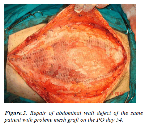 biomedres-Repair-abdominal