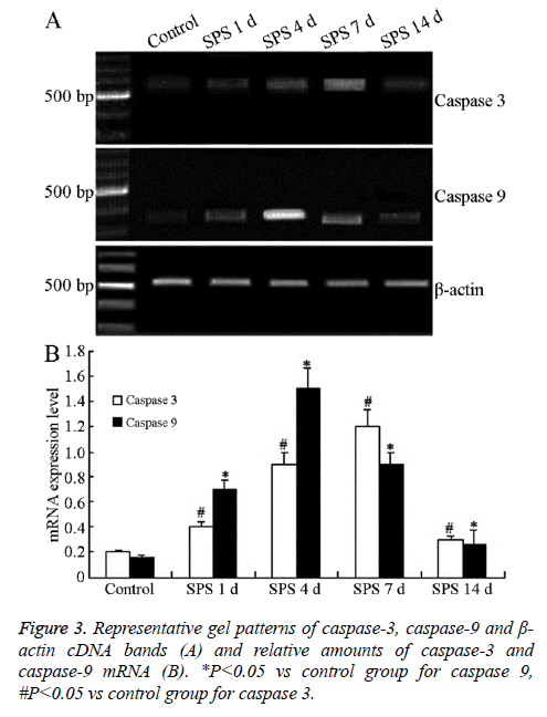 biomedres-Representative-gel-patterns