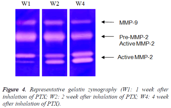 biomedres-Representative-gelatin-zymography