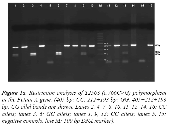 biomedres-Restriction-analysis-T256S