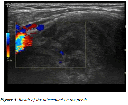 biomedres-Result-ultrasound