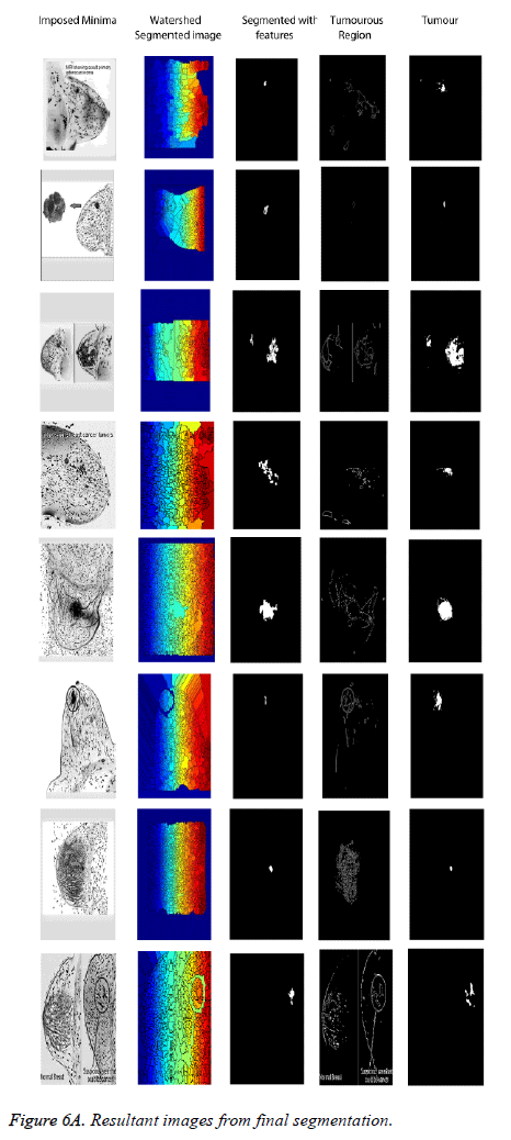 biomedres-Resultant-final-segmentation