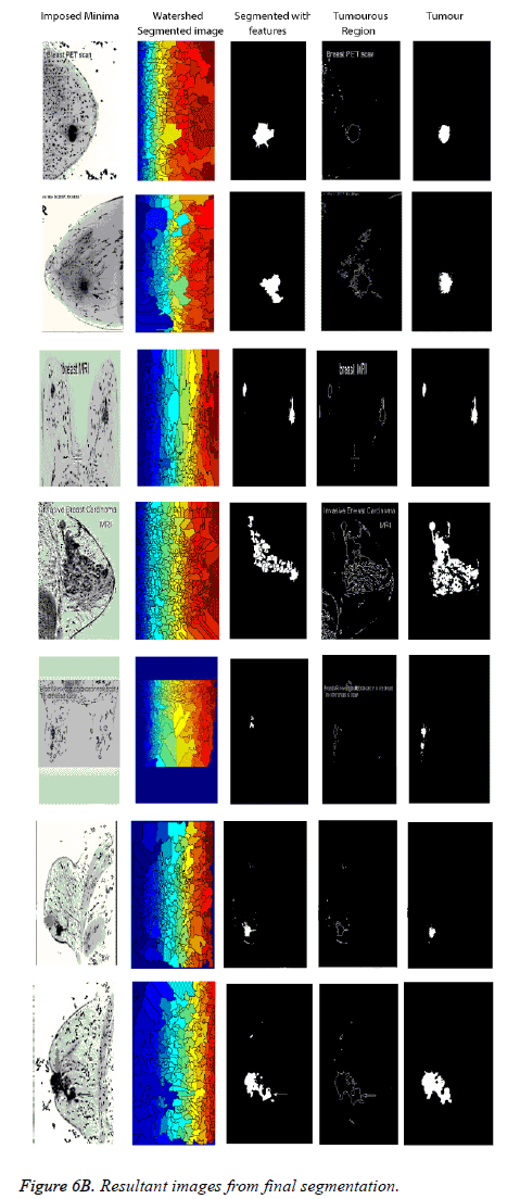 biomedres-Resultant-images-final-segmentation