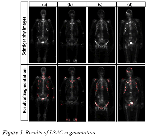 biomedres-Results-LSAC-segmentation