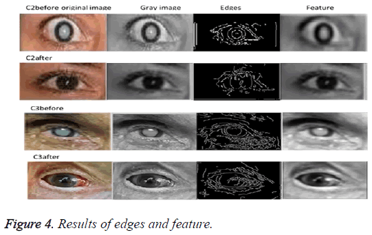 biomedres-Results-edges-feature