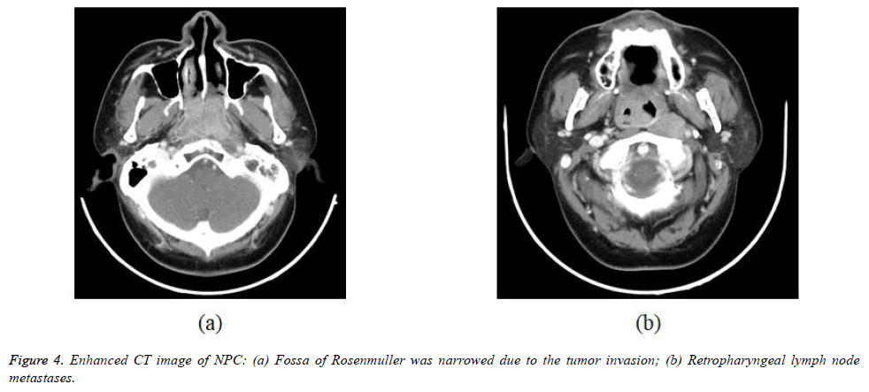 biomedres-Retropharyngeal