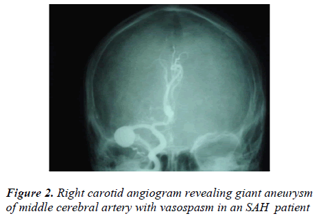 biomedres-Right-carotid-angiogram