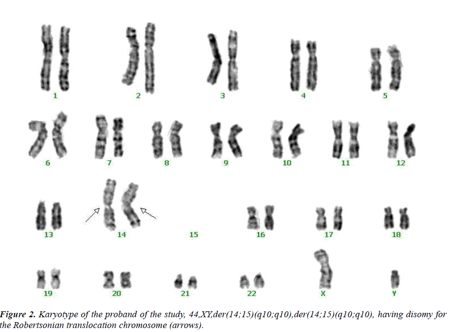 biomedres-Robertsonian-translocation