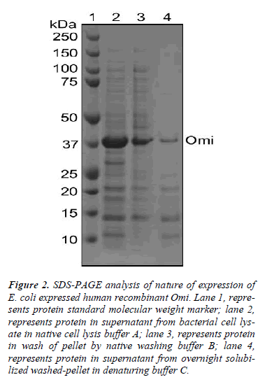 biomedres-SDS-PAGE-nature-expression