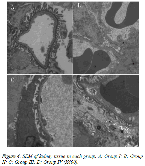 biomedres-SEM-kidney-tissue