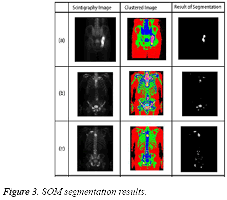 biomedres-SOM-segmentation-results