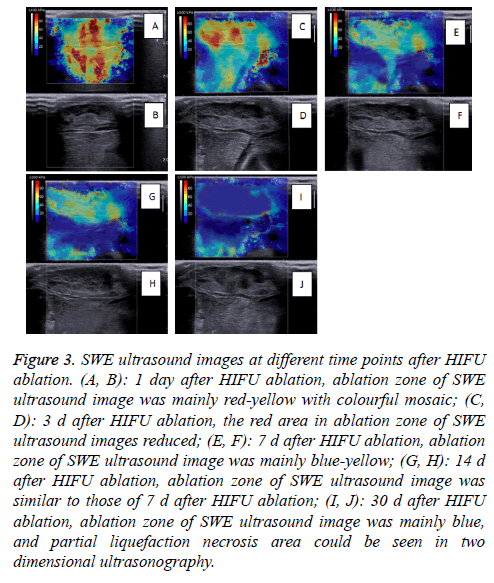 biomedres-SWE-ultrasound