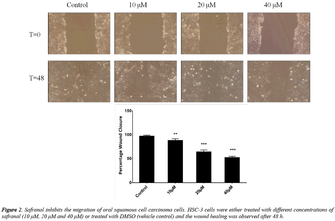 biomedres-Safranal-inhibits-migration