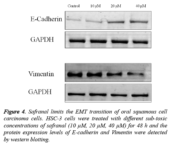 biomedres-Safranal-limits-EMT