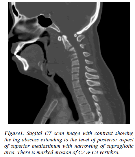 biomedres-Sagital-CT-scan-image