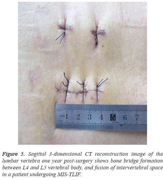 biomedres-Sagittal-3-dimensional