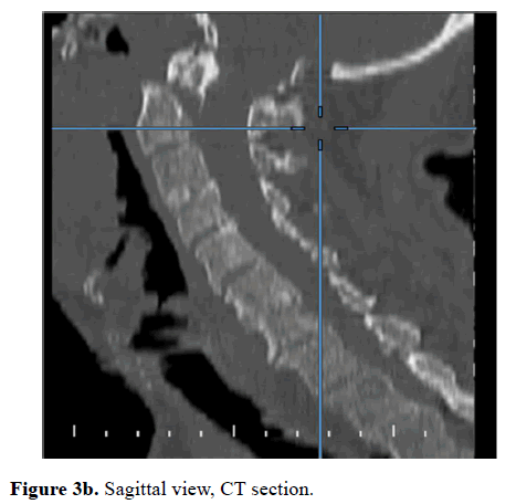 biomedres-Sagittal-view