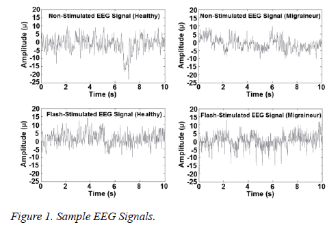 biomedres-Sample-EEG