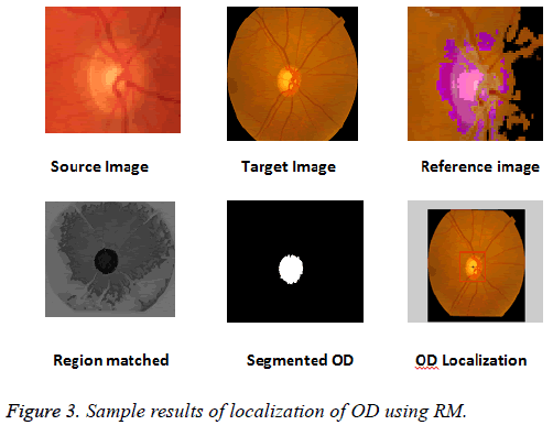 biomedres-Sample-results-localization