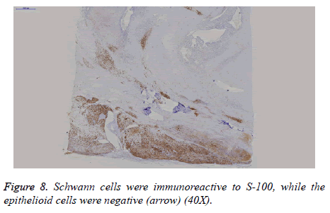 biomedres-Schwann-cells