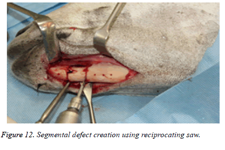 biomedres-Segmental-defect