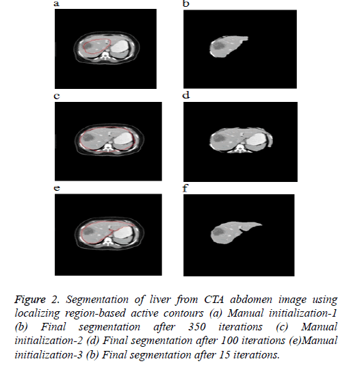 biomedres-Segmentation-liver