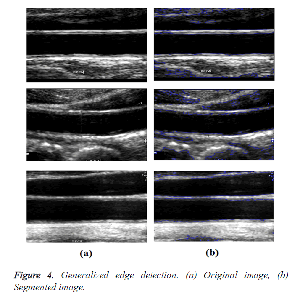 biomedres-Segmented-image