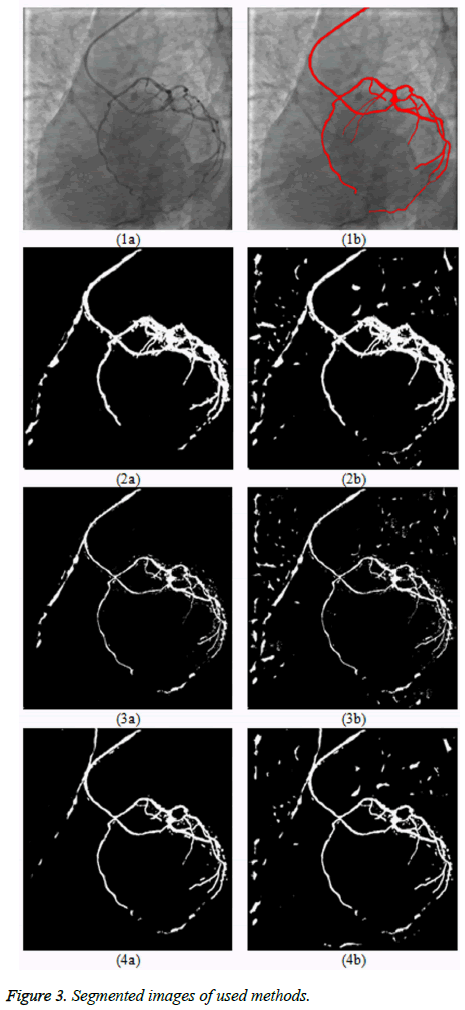 biomedres-Segmented-images