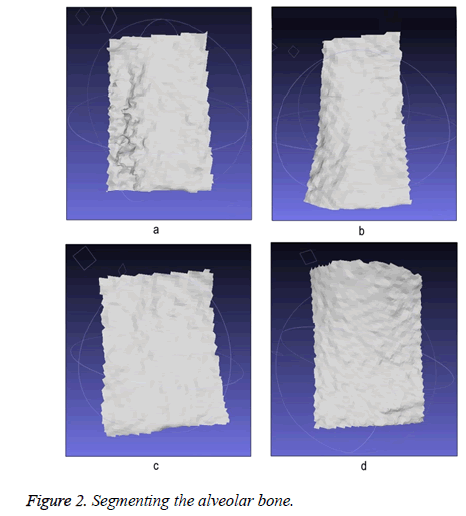 biomedres-Segmenting-bone