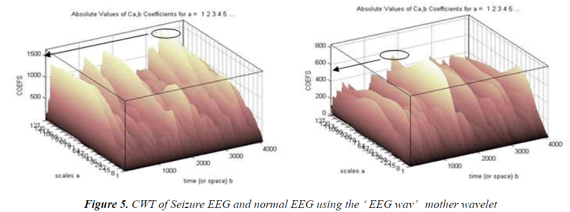 biomedres-Seizure-EEG