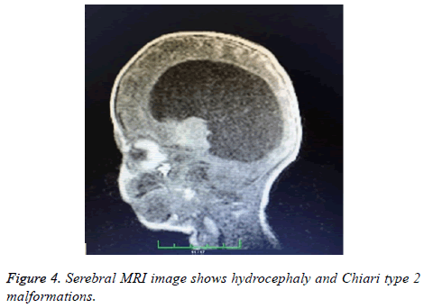 biomedres-Serebral-MRI-image
