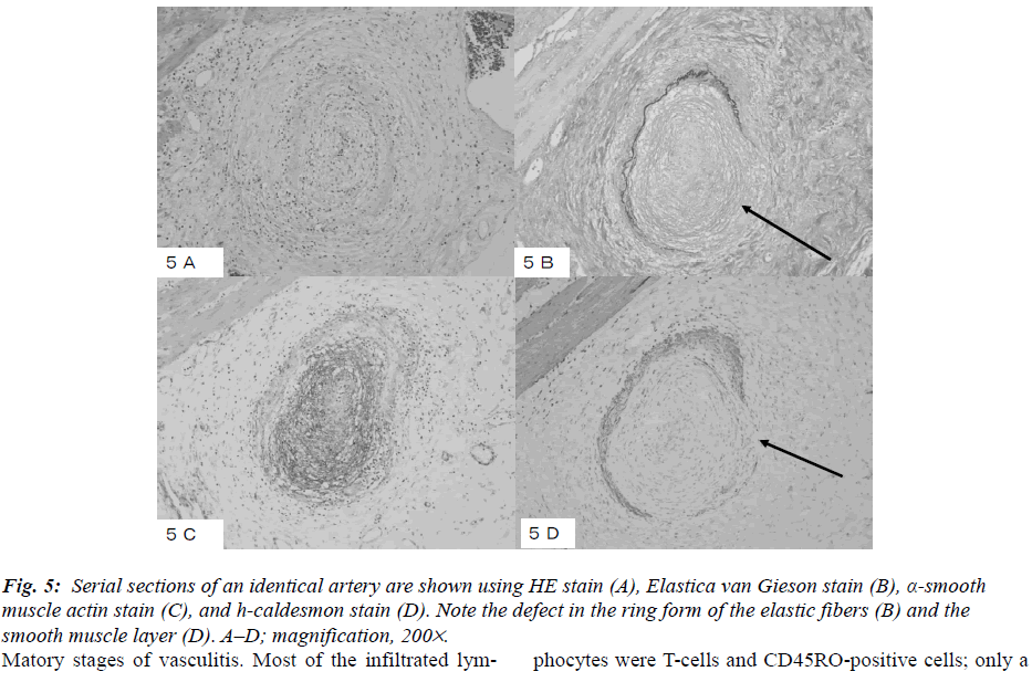 biomedres-Serial-identical-artery-HE