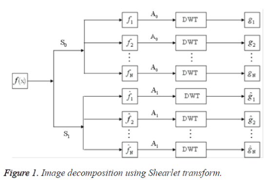 biomedres-Shearlet-transform