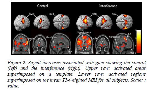 biomedres-Signal-chewing