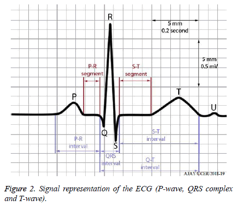 biomedres-Signal-representation