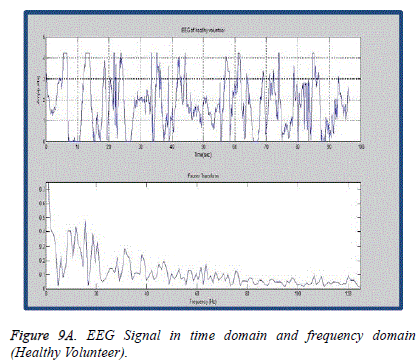 biomedres-Signal-time-domain-frequency