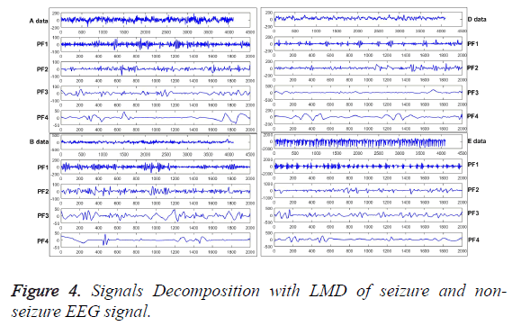 biomedres-Signals-Decomposition