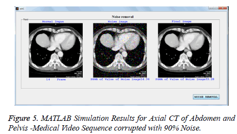 biomedres-Simulation-Results