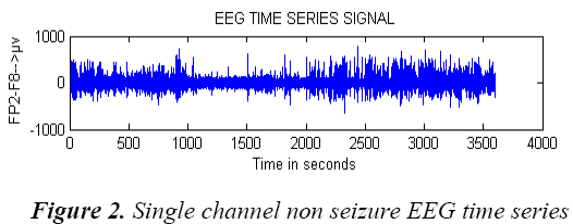 biomedres-Single-channel-seizure