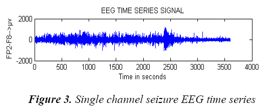 biomedres-Single-seizure-EEG-time