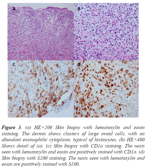 biomedres-Skin-biopsy-hematoxylin