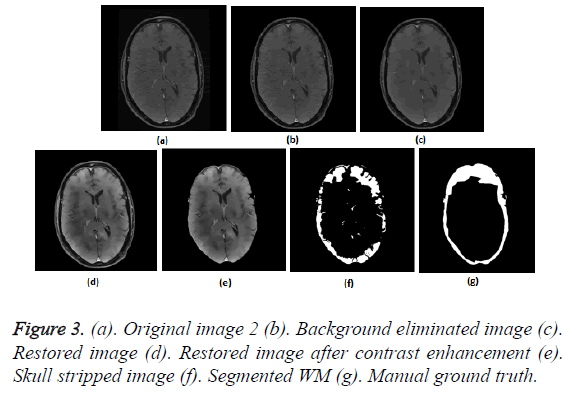 biomedres-Skull-stripped-image