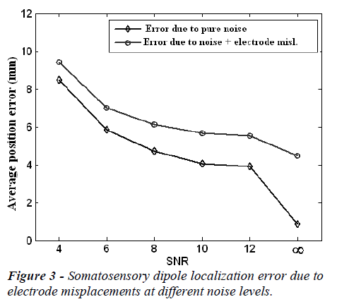 biomedres-Somatosensory-dipole-localization-error