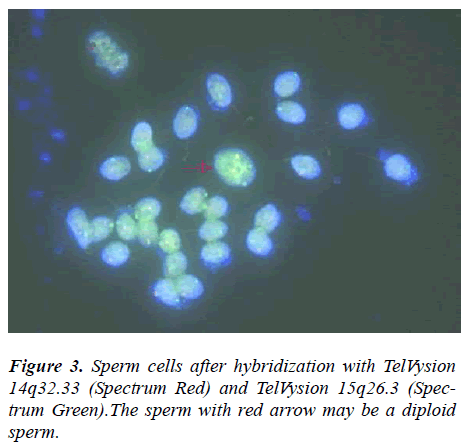 biomedres-Sperm-cells