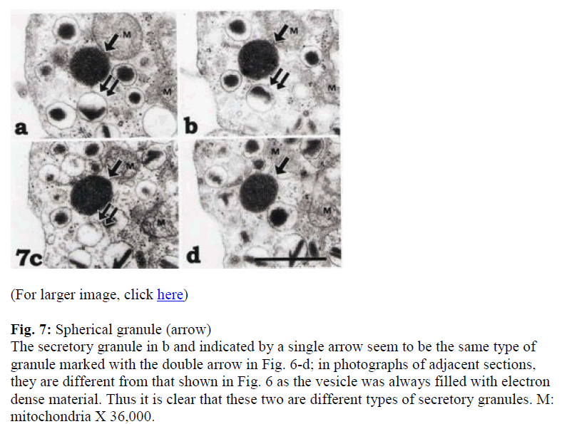 biomedres-Spherical-granule