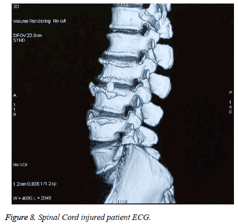 biomedres-Spinal-Cord